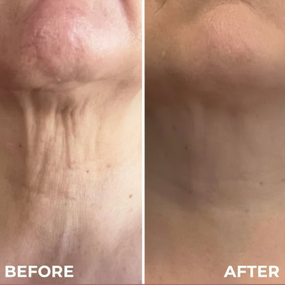 Kelviora™ Tighten & Lift Neck Cream