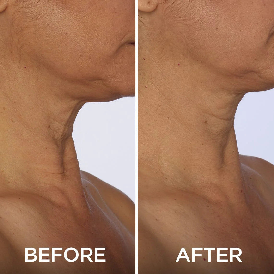 Kelviora™ Tighten & Lift Neck Cream